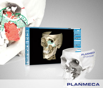 Специальные импланты Planmeca ProModel