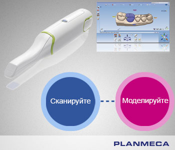 Специальные импланты Planmeca ProModel